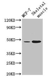 ARRDC3 Antibody