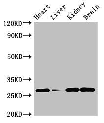 GUCD1 Antibody