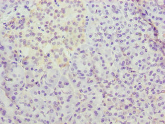 METTL25 Antibody