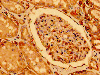 CHDH Antibody