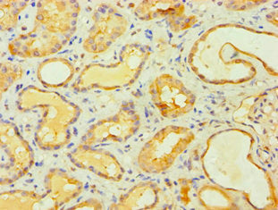 MCPH1 Antibody