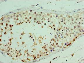 RDM1 Antibody