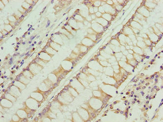 RFESD Antibody
