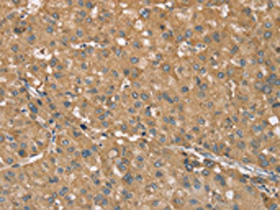 RNF148 Antibody