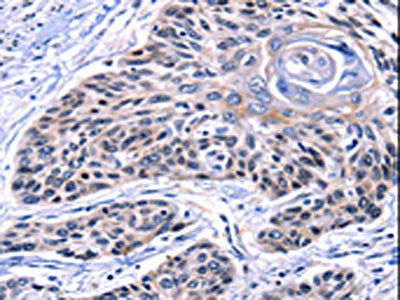 CCNB2 Antibody