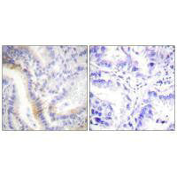 UCN Antibody