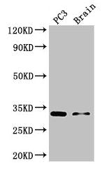 HOXB13 Antibody