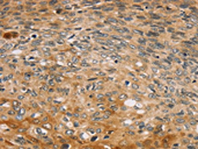 TBC1D21 Antibody