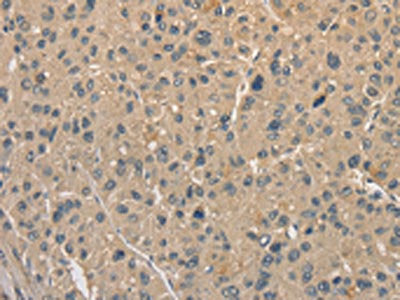 ALDH8A1 Antibody