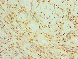 CIDEC Antibody