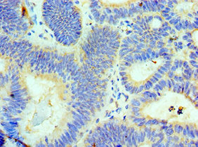 ALKBH8 Antibody
