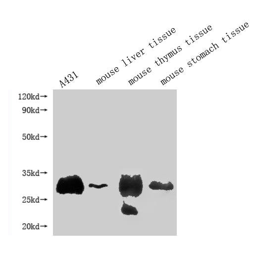 RTP4 Antibody