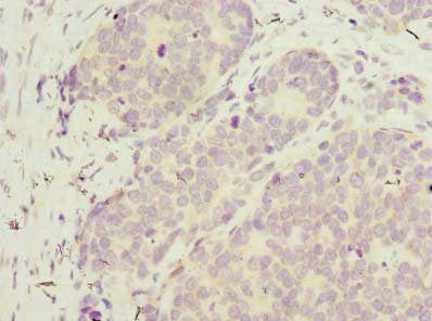 WDR89 Antibody