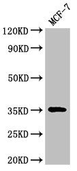 ACY3 Antibody
