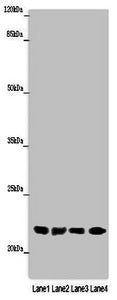 ABHD14B Antibody