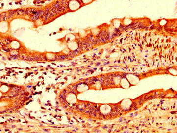 IL17F Antibody