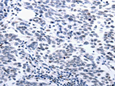 CCND1 Antibody