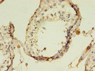 AADAT Antibody