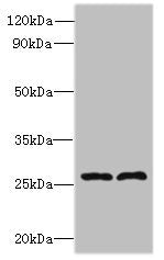FAM71C Antibody