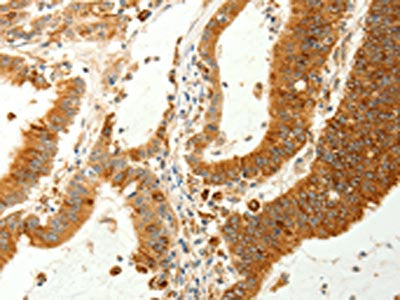 RARRES1 Antibody