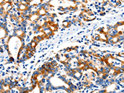 ITGAX Antibody