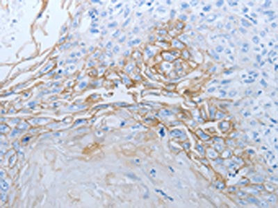 JUP Antibody