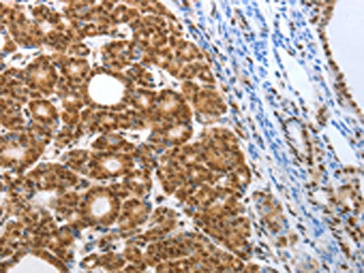 SMARCA4 Antibody