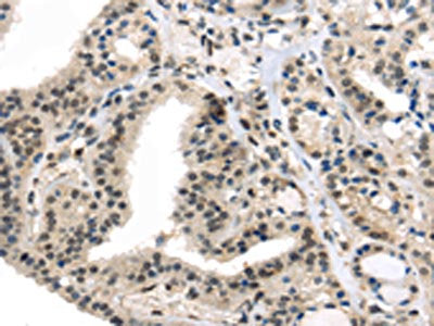 TUSC5 Antibody