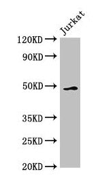 GABPB2 Antibody