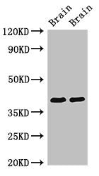 STOML3 Antibody
