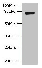 FBXO30 Antibody