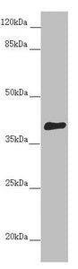 DYNC2LI1 Antibody