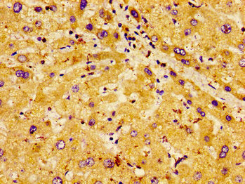 PHLDA1 Antibody