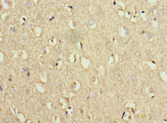 WDR60 Antibody
