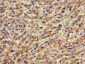 ABCA5 Antibody