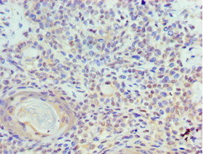 TOPBP1 Antibody