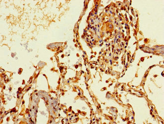 THRSP Antibody