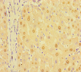RIT1 Antibody