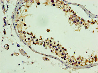 PLEKHB2 Antibody