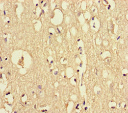 DOCK6 Antibody