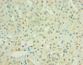 HYLS1 Antibody