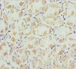 ROBO3 Antibody