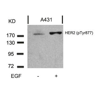 Phospho-ERBB2 (Tyr877) Antibody
