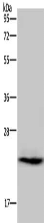 AK1 Antibody