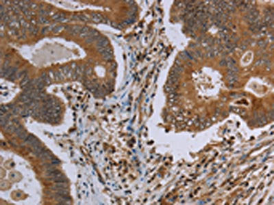 MAVS Antibody