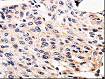 ALK Antibody