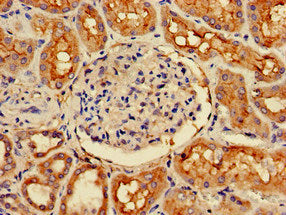 CDK5RAP2 Antibody