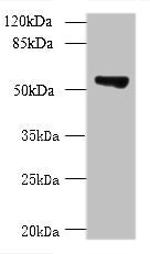 TCP11L2 Antibody