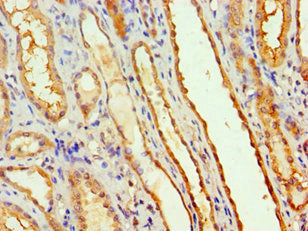 MTMR14 Antibody