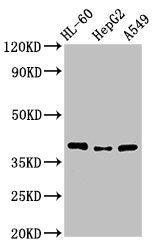 MCU Antibody